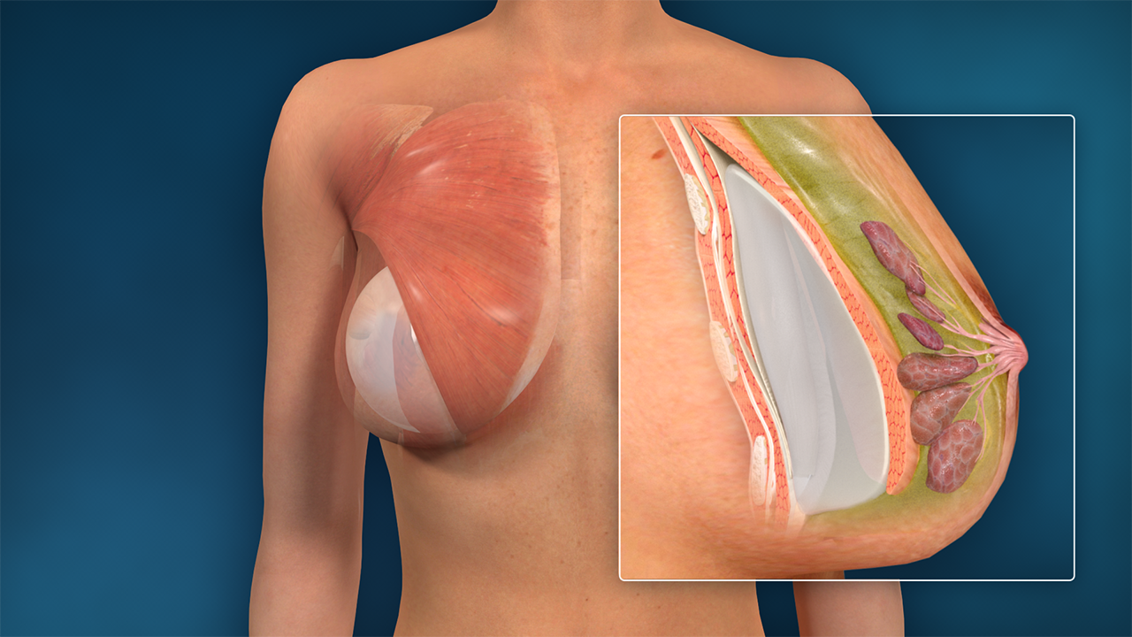Austin Breast Enhancement