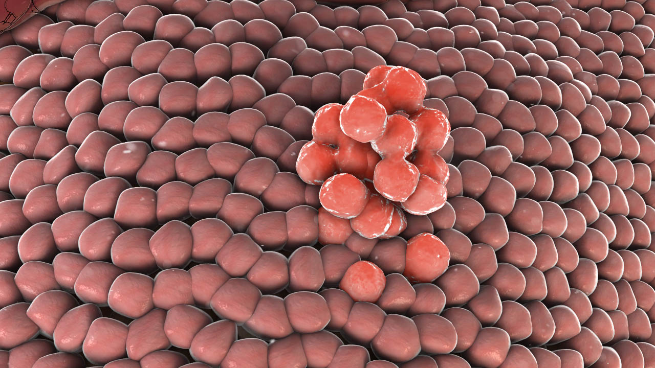 Cancer Tumor Animation